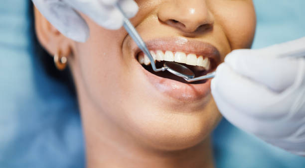 Best Emergency Cosmetic Dentistry (e.g., broken veneers) in Downs, IL